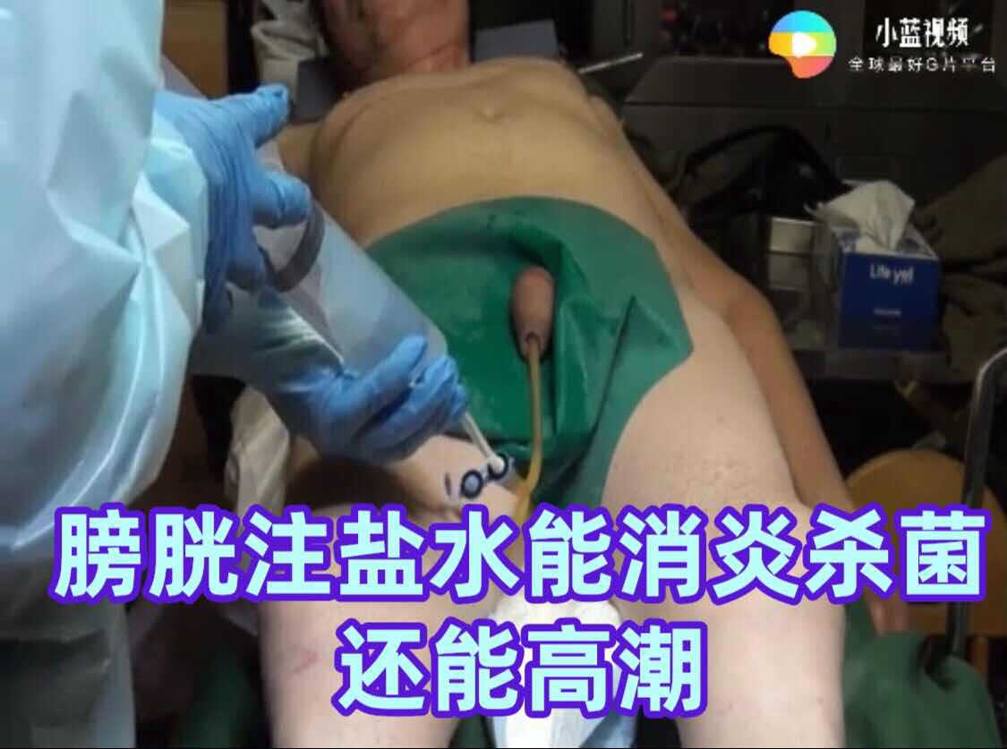 医疗调教膀胱注水